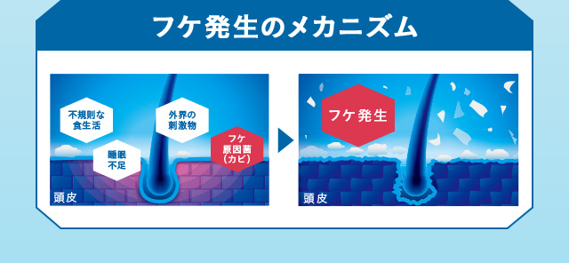 フケ発生のメカニズム