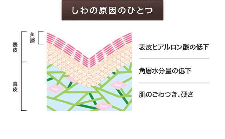 しわの原因のひとつ 表皮ヒアルロン酸の低下 角層水分量の低下 肌のごわつき、硬さ