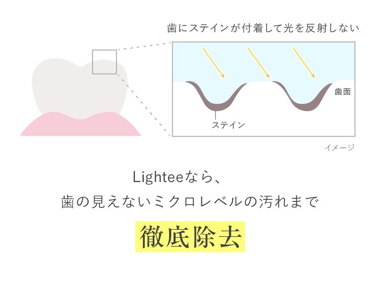Lighteeなら、歯の見えないミクロレベルの汚れまで徹底除去