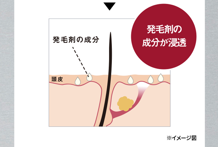 発毛剤の成分が浸透