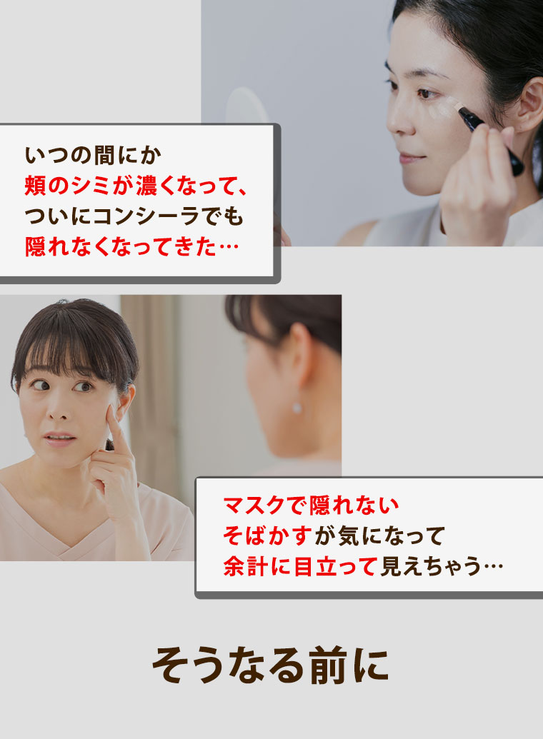 いつの間にか頬のシミが濃くなって、ついにコンシーラでも隠れなくなってきた…マスクで隠れないそばかすが気になって余計に目立って見えちゃう…そうなる前に