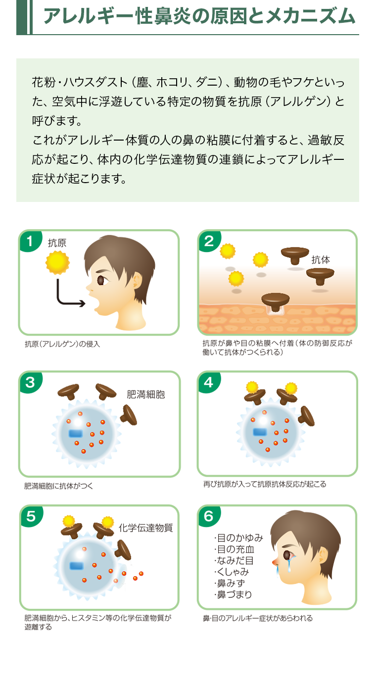 アレルギー性鼻炎の原因とメカニズム