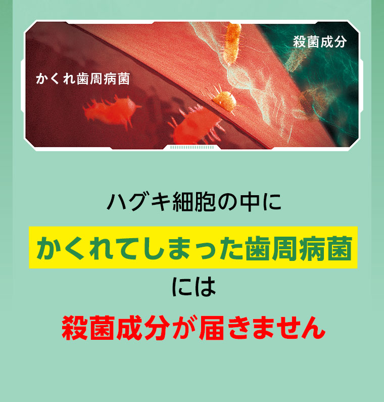 ハグキ細胞の中にかくれてしまった歯周病菌には殺菌成分が届きません
