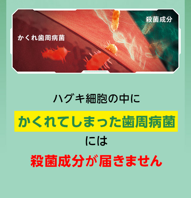 ハグキ細胞の中にかくれてしまった歯周病菌には殺菌成分が届きません