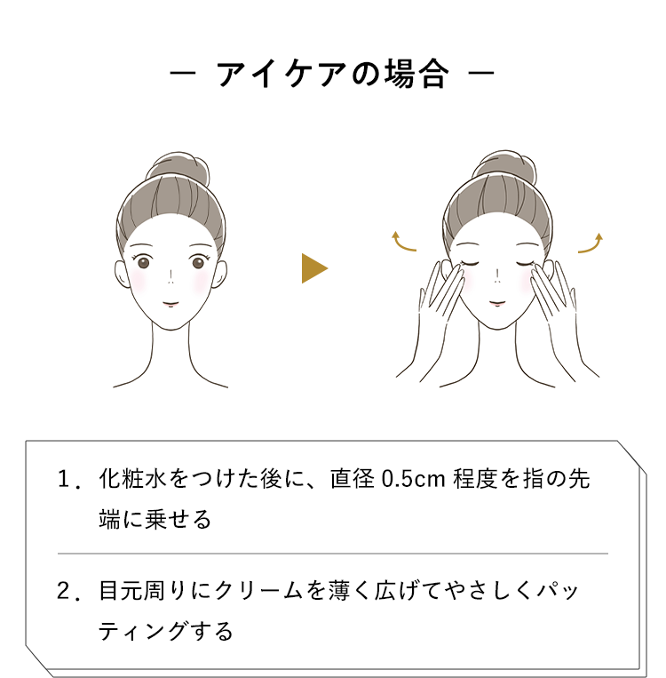 アイケアの場合