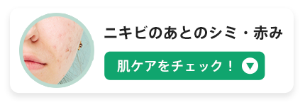 ニキビのあとのシミ・赤み　肌ケアをチェック！