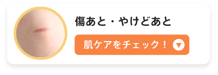 傷あと・やけどあと　肌ケアをチェック！