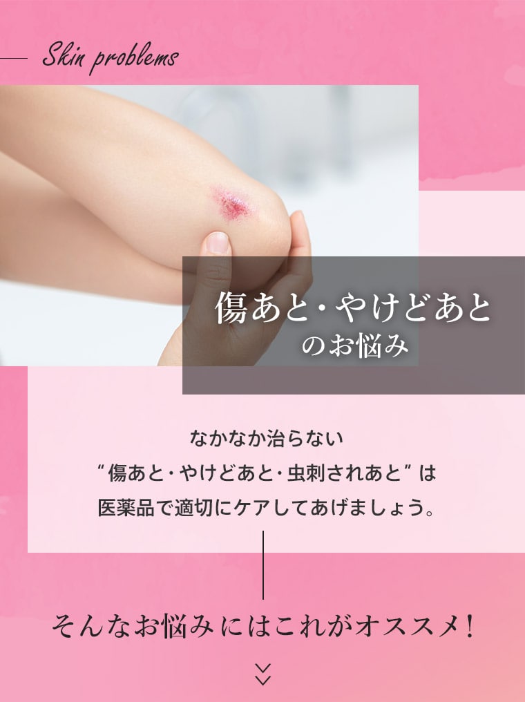 傷あと・やけどあとのお悩み　なかなか治らない“傷あと・やけどあと・虫刺されあと”は医薬品で適切にケアしてあげましょう。そんなお悩みにはこれがオススメ！