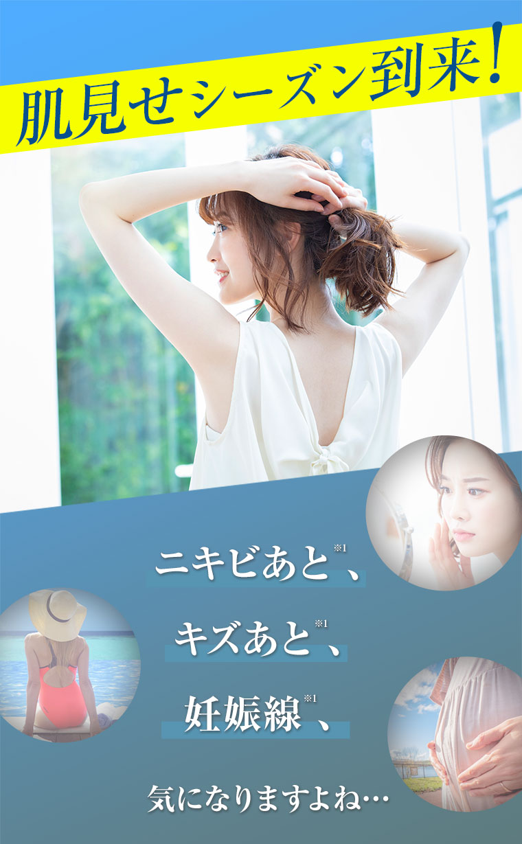 肌見せシーズン到来！ニキビあと、キズあと、妊娠線、気になりますよね…