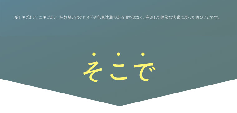 そこで！