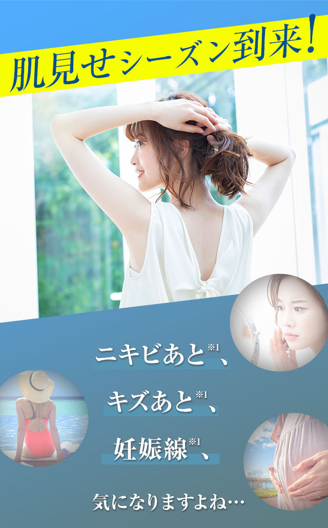 肌見せシーズン到来！ニキビあと、キズあと、妊娠線、気になりますよね…