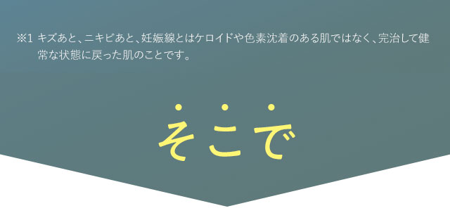 そこで！