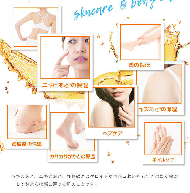 顔にもカラダにも使えるバイオイル。色々な箇所の保湿ケアに活用できます。