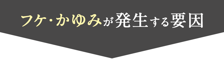フケ・かゆみが発生する要因