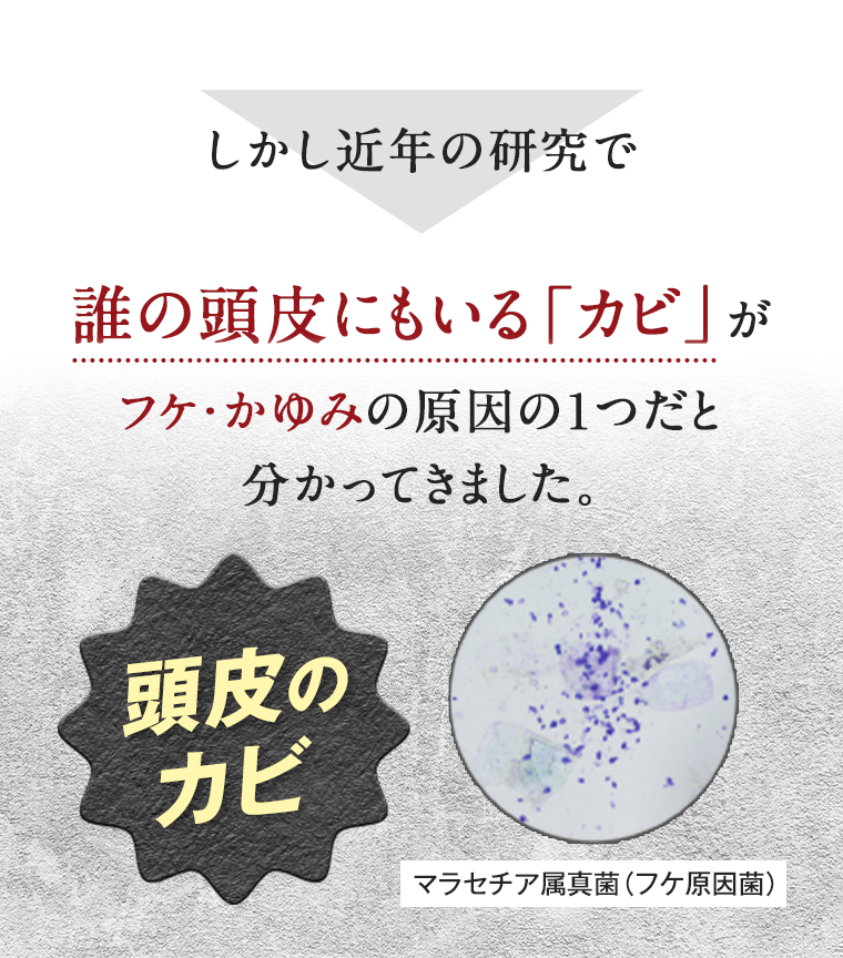 しかし近年の研究で誰の頭皮にもいる「カビ」がフケ・かゆみの原因の1つだと分かってきました。