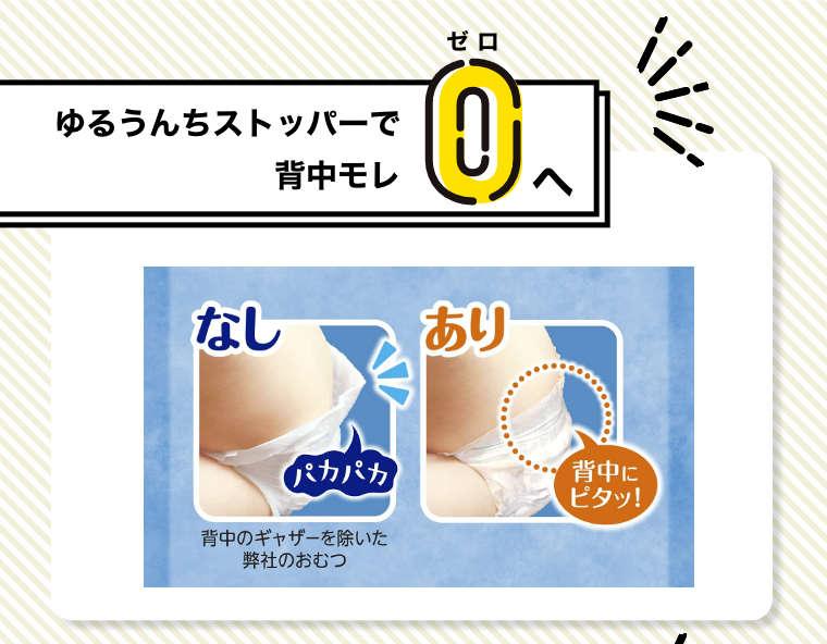 ゆるうんちストッパーで背中モレゼロへ