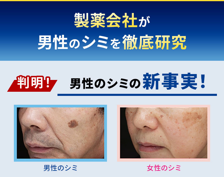 製薬会社が男性のシミを徹底研究