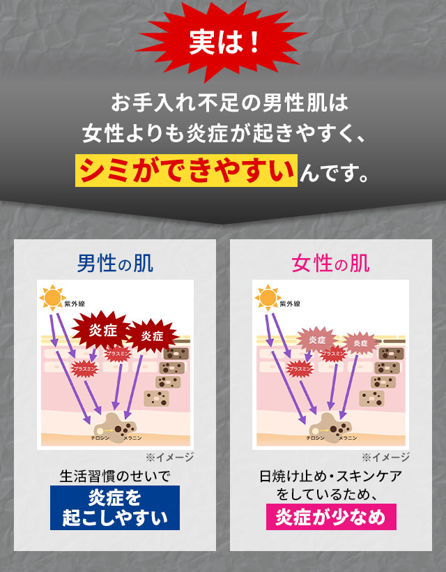 実は！お手入れ不足の男性肌は女性より炎症が起きやすく、シミができやすいんです。