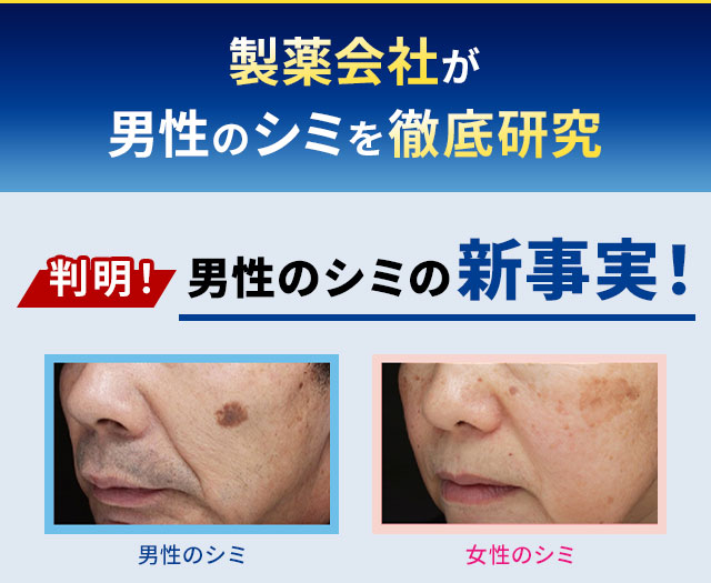 製薬会社が男性のシミを徹底研究