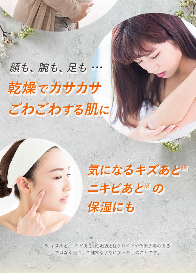感想でカサカサごわごわする肌に　気になるキズあとニキあとの保湿にも