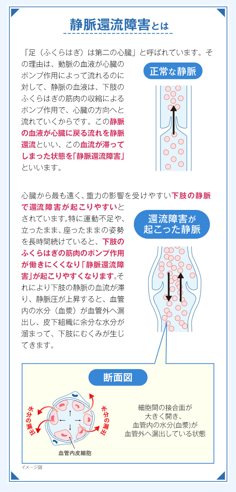 静脈還流障害とは