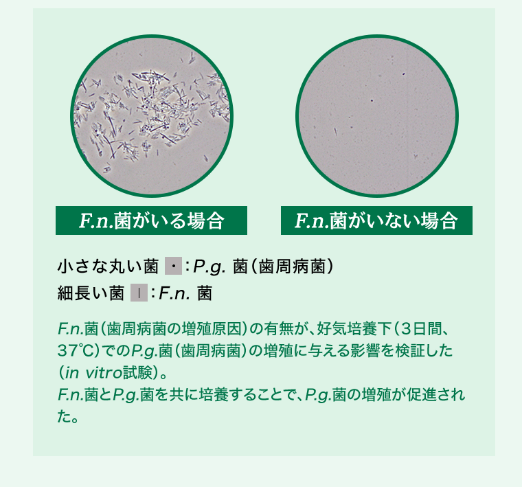 [F.n.菌がいる場合] [F.n.菌がいない場合] 小さな丸い菌：P.g.菌（歯周病菌）細長い菌：F.n.菌　F.n.菌（歯周病菌の増殖原因）の有無が、好気培養下（3日間、37℃）でのP.g.菌（歯周病菌）の増殖に与える影響を検証した（in vitro試験）。F.n.菌とP.g.菌を共に培養することで、P.g.菌の増殖が促進された。