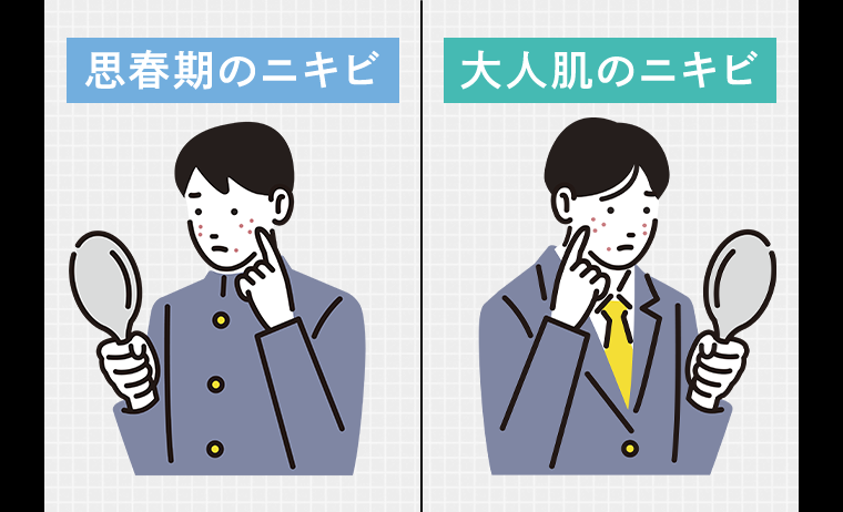 思春期のニキビ 大人肌のニキビ