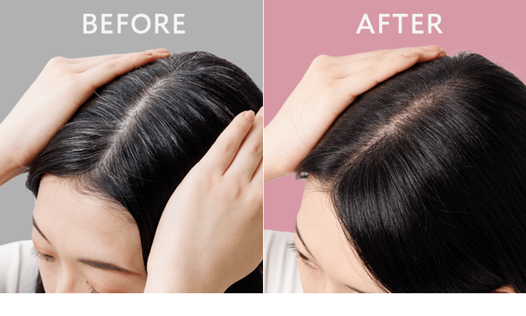 BEFORE｜AFTER
