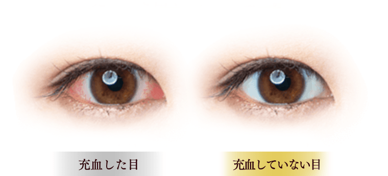 充血した目／充血していない目