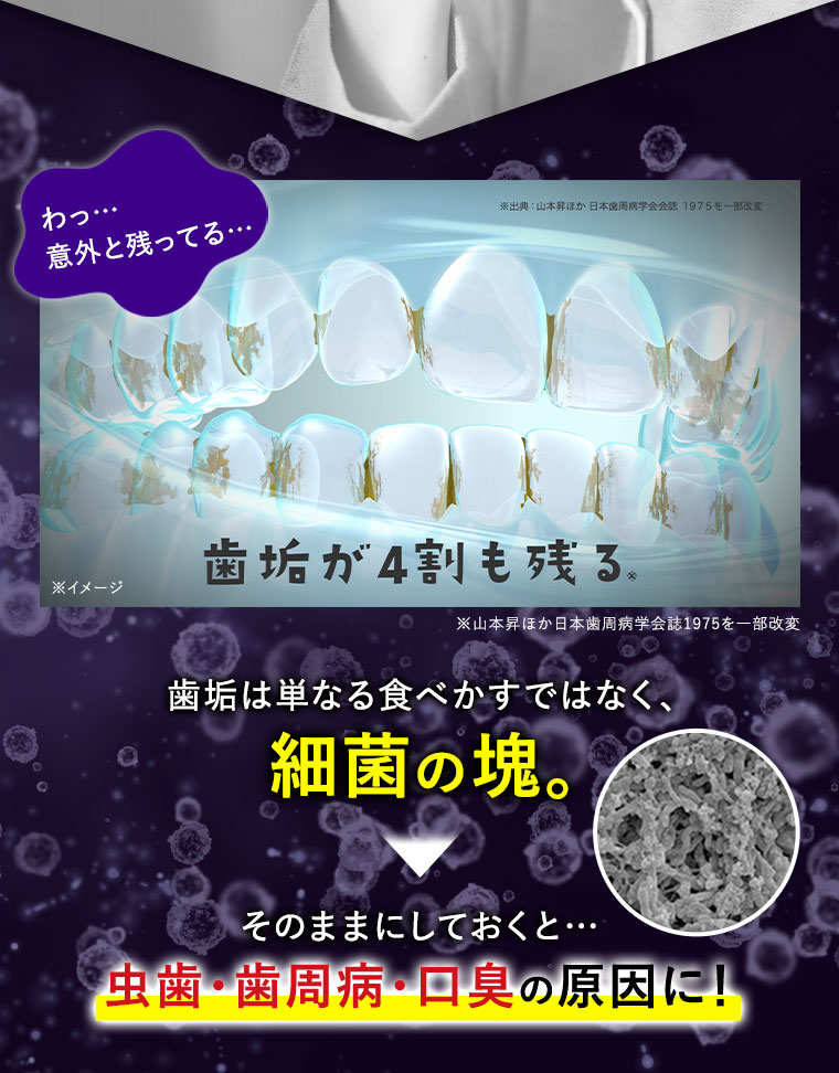 歯垢は単なる食べかすではなく、細菌の塊。そのままにしておくと…虫歯・歯周病・口臭の原因に！