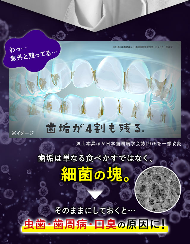 歯垢は単なる食べかすではなく、細菌の塊。そのままにしておくと…虫歯・歯周病・口臭の原因に！