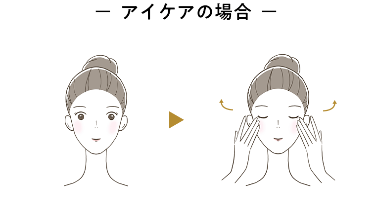 アイケアの場合
