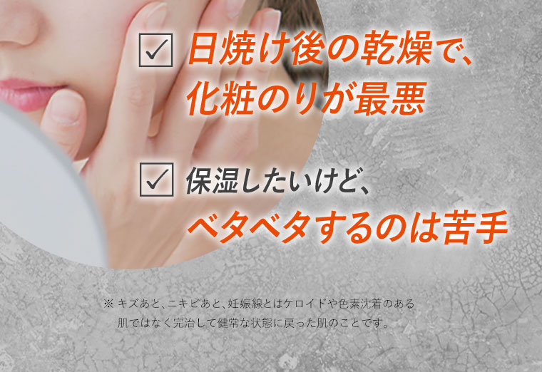 日焼け後の乾燥で、化粧のりが最悪　保湿したいけど、ベタベタするのは苦手
