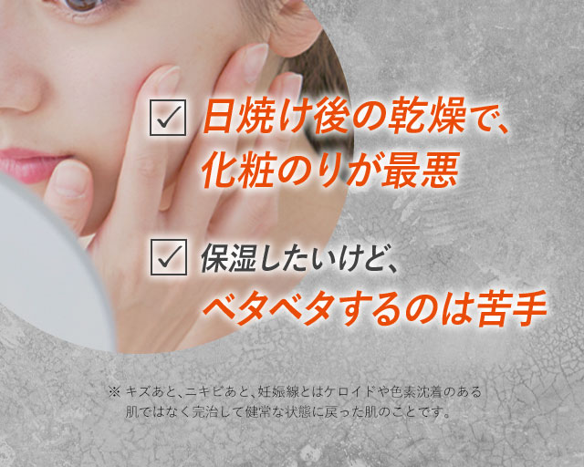 日焼け後の乾燥で、化粧のりが最悪　保湿したいけど、ベタベタするのは苦手
