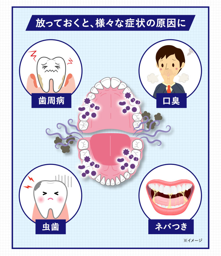 放っておくと、様々な症状の原因に　歯周病　口臭　虫歯　ネバつき