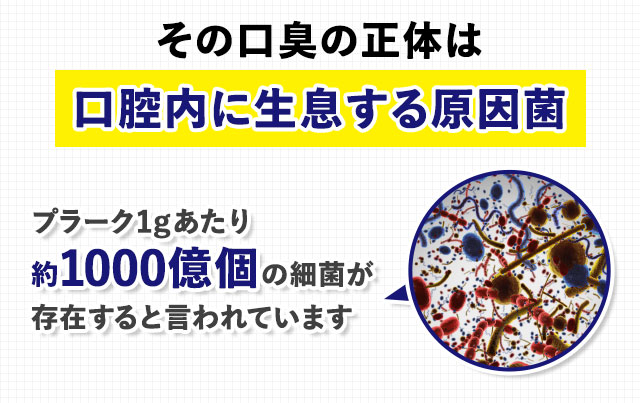 その口臭の正体は口腔内に生息する原因菌