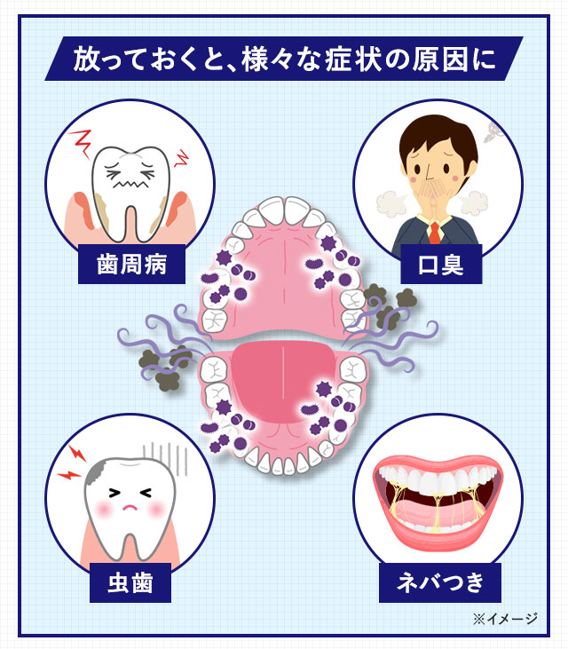 放っておくと、様々な症状の原因に　歯周病　口臭　虫歯　ネバつき