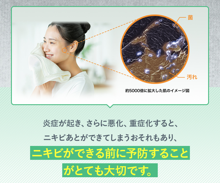 炎症が起き、さらに悪化、重症化すると、ニキビあとができてしまうおそれもあり、ニキビができる前に予防することがとても大切です。