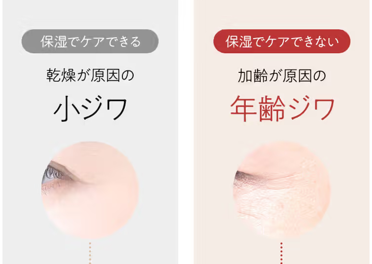 保湿でケアできる乾燥が原因の小ジワ 保湿でケアできない加齢が原因の年齢ジワ