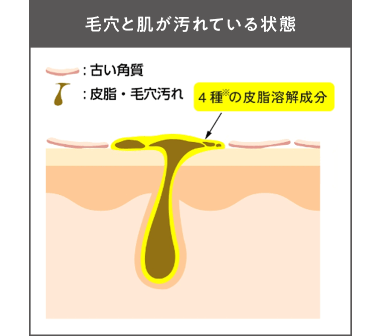 毛穴と肌が汚れている状態