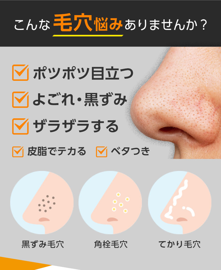 こんな毛穴悩みありませんか？