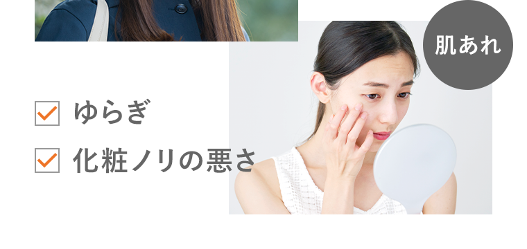 肌あれ ゆらぎ 化粧ノリの悪さ