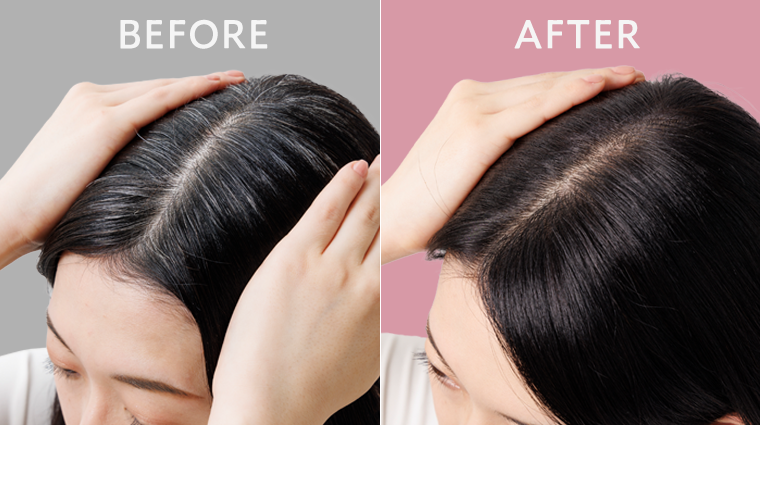 BEFORE｜AFTER