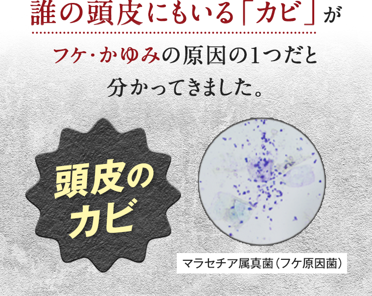 誰の頭皮にもいる「カビ」がフケ・かゆみの原因の１つだと分かってきました。 頭皮のカビ マラセチア属真菌(フケ原因菌)