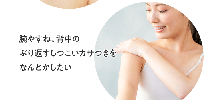 腕やすね、背中のぶり返すしつこいカサつきをなんとかしたい