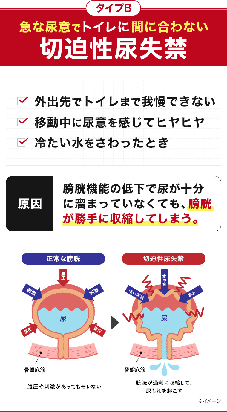 タイプB 急な尿意でトイレに間に合わない切迫性尿失禁