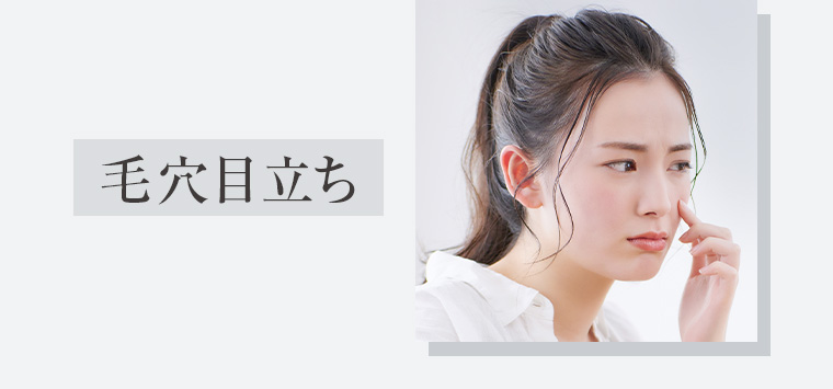 毛穴目立ち