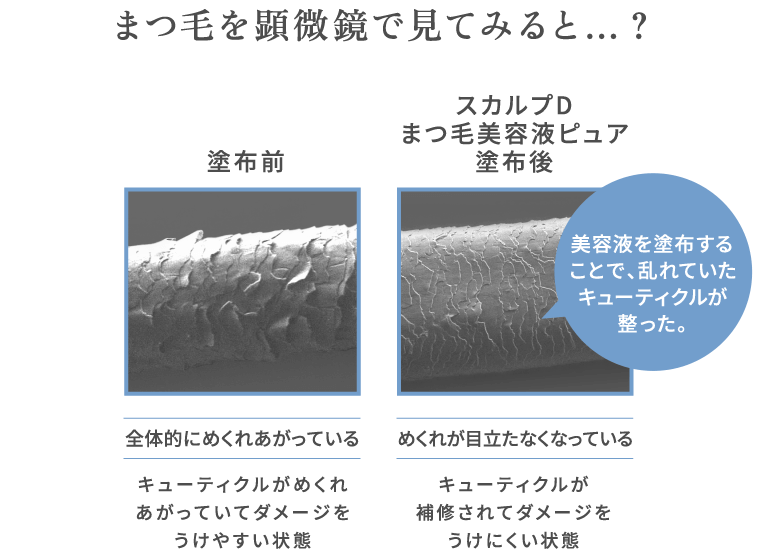 まつ毛を顕微鏡で見てみると…？