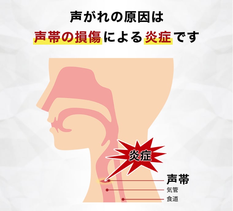 声がれの原因は声帯の損傷による炎症です