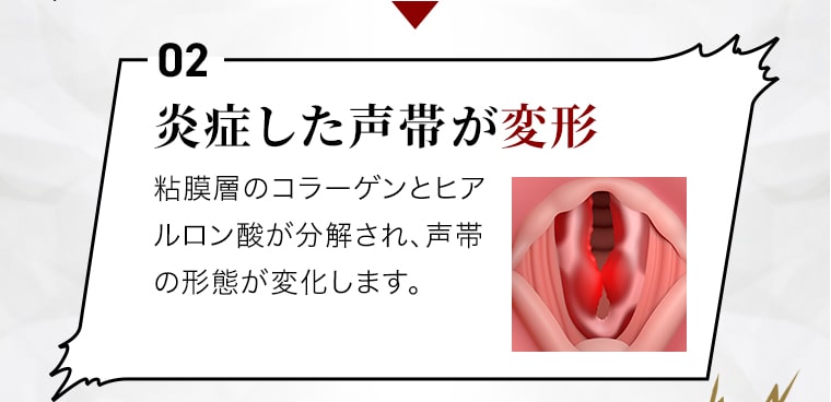 【炎症した声帯が変形】粘膜層のヒアルロン酸が分解され、コラーゲンが沈着することで声帯の形態が変化します。